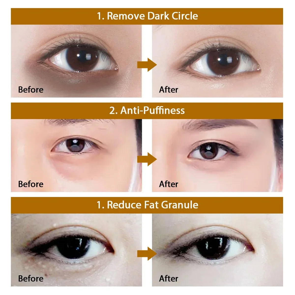 60pcs Hyaluronic Acid Repair Eye Mask Relieve Eye Fatigue Remove Dark Circles Moisturizing Korean Skin Care Crystal Eye Masks